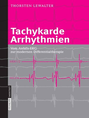 cover image of Tachykarde Arrhythmien